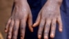 16x9 Image