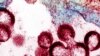 HIV virions budding and releasing from an infected cell