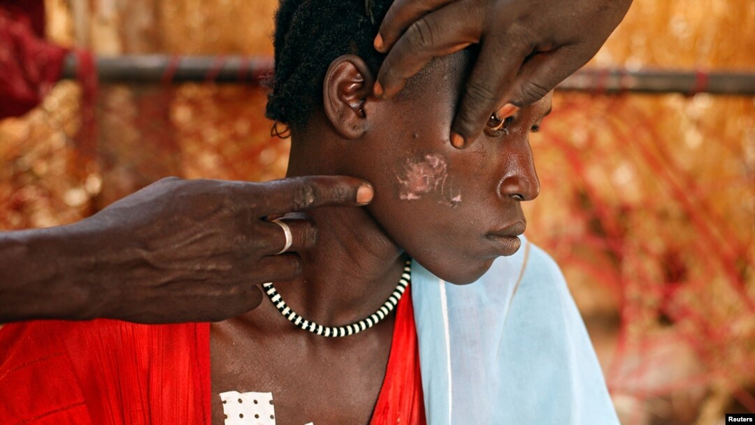 A Nuba woman, injured during a raid by Sudan's air force, sits in a makeshift hospital in South Kordofan in April 2012. 