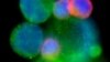 Image shows circulating tumor cell cluster of patient in unrelated study (undated file image).