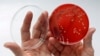 FILE- An employee displays MRSA (Methicillin-resistant Staphylococcus aureus) bacteria inside a petri dish containing agar jelly for bacterial culture in a microbiological laboratory in Berlin.