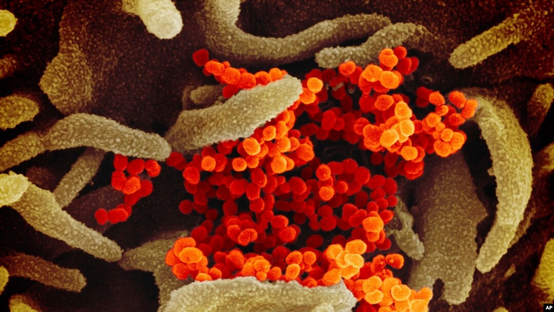 The National Institute of Allergy and Infectious Diseases provided this image of SARS-CoV-2 (orange), also known as 2019-nCoV, the virus that causes COVID-19, isolated from a patient in the U.S., emerging from the surface of cells cultured in the lab.