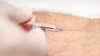 FILE - A blood test.