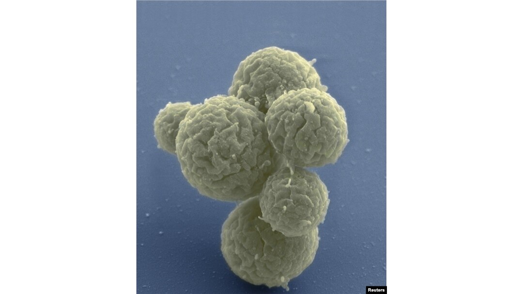 This electron micrograph image shows synthetic cell clusters magnified at about 15,000 times, in this image released March 24, 2016. Scientists announced Thursday the creation of a synthetic organism stripped down to the bare essentials.