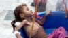 FILE - In this Aug. 25, 2018, image made from video, a severely malnourished girl is weighed at the Aslam Health Center in Hajjah, Yemen.