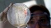FILE - A laboratory worker looks for strains of E.coli bacteria in vegetable cells placed in a petri dish.