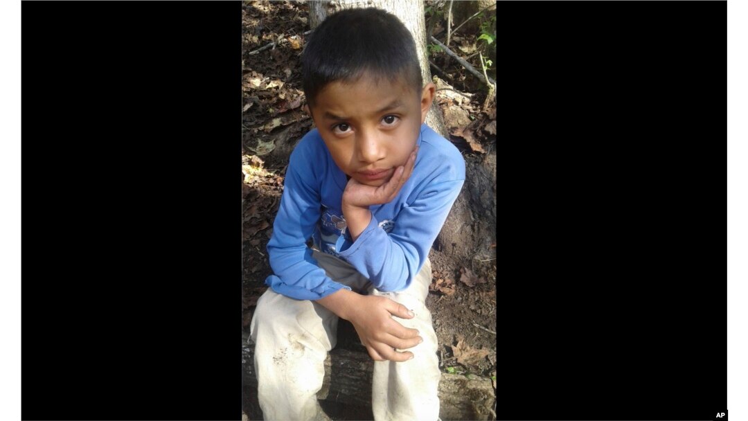 FILE - Felipe Gomez Alonzo, 8, is shown in Yalambojoch, Guatemala, in this photo provided by his family.
