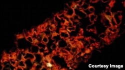 This is a micrograph of a tobacco leaf (N. benthamiana) with the Ebola monoclonal fluorescently labeled within the plant cells. (Dr. Jeffrey Pudney, Boston University)