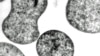 Pyrococcus furiosus (Henry Aldrich, ifas.ufl.edu)
