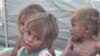 UN Official Warns of Imminent Great Hunger in Yemen