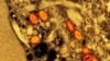 FILE - Colorized transmission electron micrograph of mpox virus particles captured at the NIAID Integrated Research Facility in Fort Detrick
