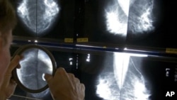 cancer breast
